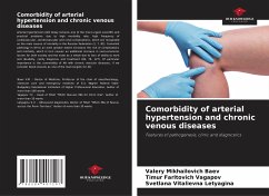 Comorbidity of arterial hypertension and chronic venous diseases - Baev, Valery Mikhailovich;Vagapov, Timur Faritovich;Letyagina, Svetlana Vitalievna