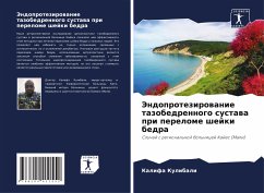 Jendoprotezirowanie tazobedrennogo sustawa pri perelome shejki bedra - Kulibali, Kalifa