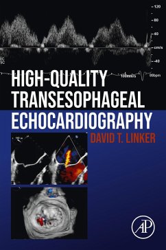 High-Quality Transesophageal Echocardiography (eBook, ePUB) - Linker, David T.