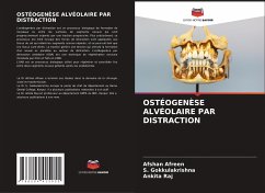 OSTÉOGENÈSE ALVÉOLAIRE PAR DISTRACTION - Afreen, Afshan;Gokkulakrishna, S.;Raj, Ankita