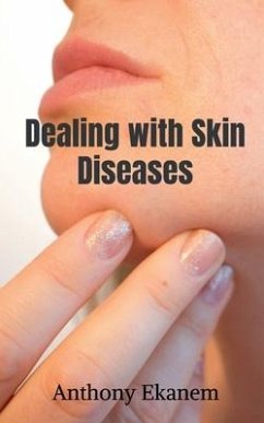 Dealing with Skin Diseases - Ekanem, Anthony