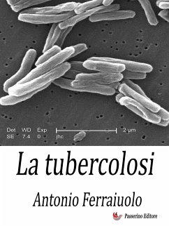 La tubercolosi (eBook, ePUB) - Ferraiuolo, Antonio