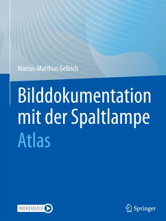 Bilddokumentation mit der Spaltlampe - Gellrich, Marcus-Matthias