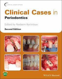 Clinical Cases in Periodontics (eBook, ePUB)