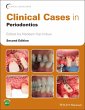 Clinical Cases in Periodontics (eBook,... - Bild 1