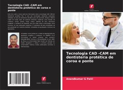 Tecnologia CAD -CAM em dentisteria protética de coroa e ponte - Patil, Anandkumar G