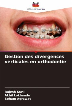 Gestion des divergences verticales en orthodontie - Kuril, Rajesh;Lokhande, Akhil;Agrawat, Soham