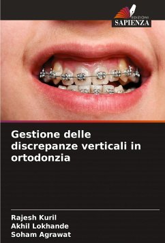 Gestione delle discrepanze verticali in ortodonzia - Kuril, Rajesh;Lokhande, Akhil;Agrawat, Soham