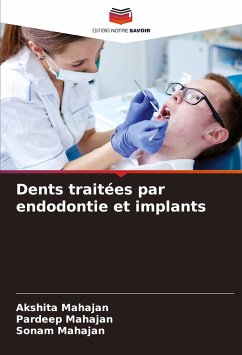 Dents traitées par endodontie et implants - Mahajan, Akshita;Mahajan, Pardeep;Mahajan, Sonam