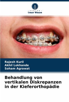 Behandlung von vertikalen Diskrepanzen in der Kieferorthopädie - Kuril, Rajesh;Lokhande, Akhil;Agrawat, Soham