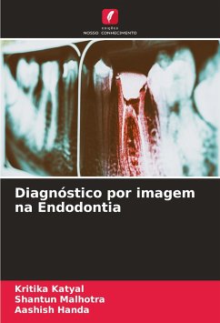Diagnóstico por imagem na Endodontia - Katyal, Kritika;Malhotra, Shantun;Handa, Aashish