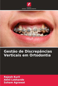 Gestão de Discrepâncias Verticais em Ortodontia - Kuril, Rajesh;Lokhande, Akhil;Agrawat, Soham