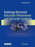 Radiology Illustrated: Nutcracker Phenomenon and Nutcracker Syndrome (eBook, PDF)