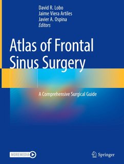 Atlas of Frontal Sinus Surgery