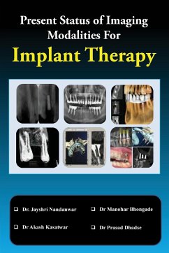 Present Status of Imaging Modalities For Implant Therapy - Nandanwar, Jayshri; Bhongade, Manohar