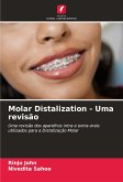 Molar Distalization - Uma revisão