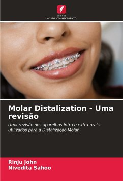 Molar Distalization - Uma revisão - John, Rinju;Sahoo, Nivedita