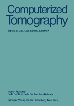 Computerized Tomography (eBook, PDF)