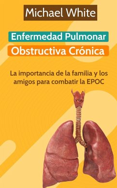 Cover Enfermedad Pulmonar Obstructiva Crónica: La importancia de la familia y los amigos para combatir la EPOC (eBook, ePUB)