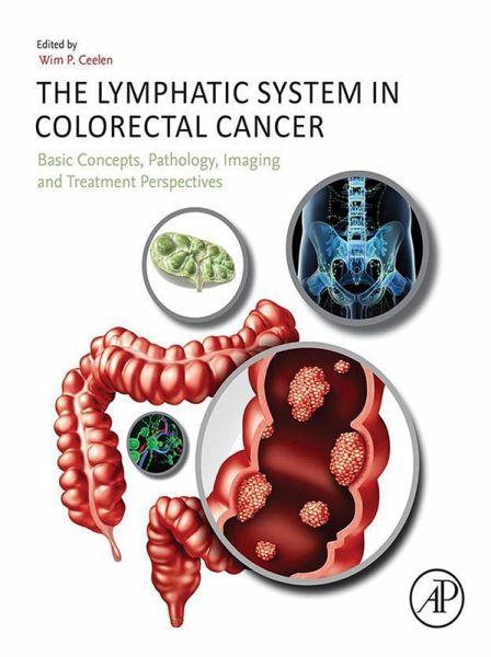 The Lymphatic System in Colorectal Cancer (eBook, ePUB) The Lymphatic System in Colorectal Cancer (eBook, ePUB)