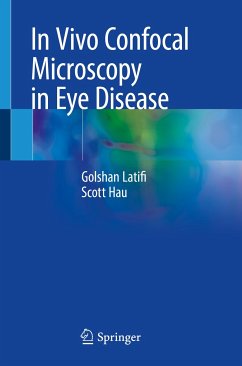 In Vivo Confocal Microscopy in Eye Disease (eBook, PDF) - Latifi, Golshan; Hau, Scott