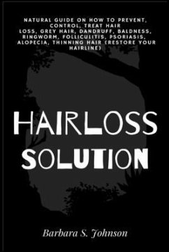Hairloss Solution - Johnson, Barbara S