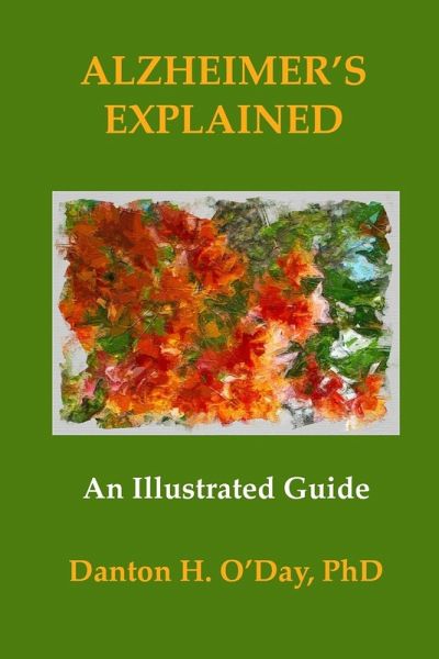Alzheimer's Explained, An Illustrated Guide Alzheimer's Explained, An Illustrated Guide