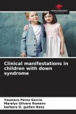 Clinical manifestations in children with down syndrome