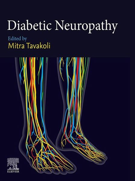 Diabetic Neuropathy (eBook, ePUB) Diabetic Neuropathy (eBook, ePUB)