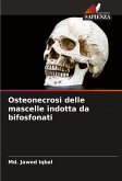 Osteonecrosi delle mascelle indotta da bifosfonati