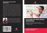 OCLUSÃO EM IMPLANTES DENTÁRIOS