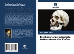 Bisphosphonat-induzierte Osteonekrose des Kiefers - Iqbal, Md. Jawed