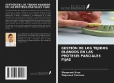 GESTIÓN DE LOS TEJIDOS BLANDOS EN LAS PRÓTESIS PARCIALES FIJAS