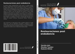 Restauraciones post endodoncia - Jain, Varsha; Tandan, Monika; Mittal, Rakesh