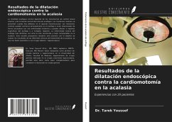 Resultados de la dilatación endoscópica contra la cardiomotomía en la acalasia - Youssef, Tarek