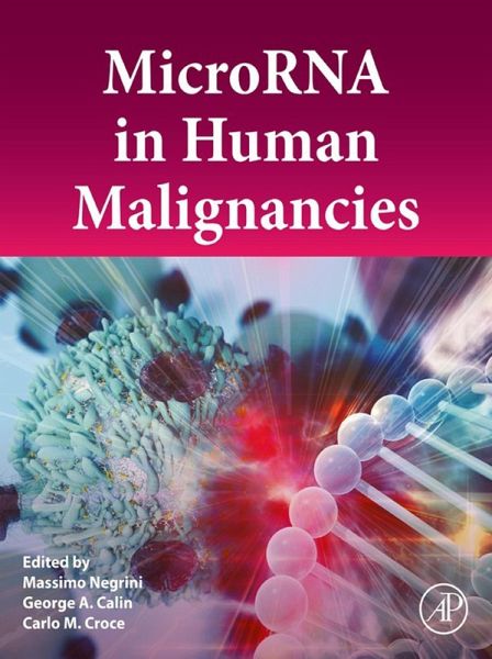 MicroRNA in Human Malignancies (eBook, ePUB) MicroRNA in Human Malignancies (eBook, ePUB)