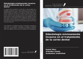 Odontología mínimamente invasiva en el tratamiento de la caries dental