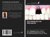 OCLUSIÓN EN LOS IMPLANTES