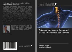 Osteoporosis: una enfermedad clásica relacionada con la edad - Gusain, Neelam; Kanyal Butola, Lata