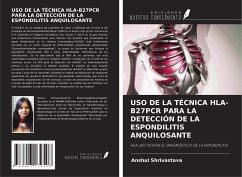 USO DE LA TÉCNICA HLA-B27PCR PARA LA DETECCIÓN DE LA ESPONDILITIS ANQUILOSANTE - Shrivastava, Anshul