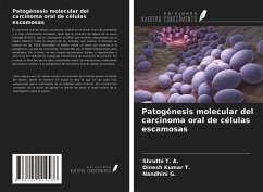 Patogénesis molecular del carcinoma oral de células escamosas - T. A., Shruthi; T., Dinesh Kumar; G., Nandhini