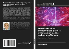 Nuevas técnicas endoscópicas para la erradicación de las varices esofágicas - Mansour, Loai