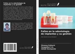 Fallos en la odontología de implantes y su gestión - Kulkarni, Shreeya; S. A., Gangadhar; Deshpande, Abhijit
