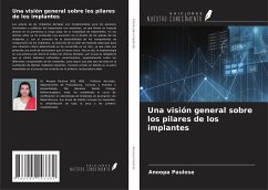 Cover Una visión general sobre los pilares de los implantes