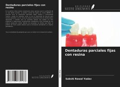 Dentaduras parciales fijas con resina - Rawal Yadav, Sakshi