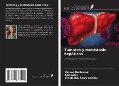 Tumores y metástasis hepáticas - Dachraoui, Chaima; Askri, Anis; Yosra Slimeni, Eya Rachdi