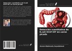 Detección cuantitativa de E.coli O157:H7 en carne picada