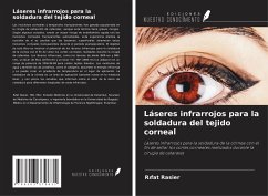 Láseres infrarrojos para la soldadura del tejido corneal - Rasier, R¿fat