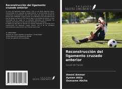 Reconstrucción del ligamento cruzado anterior - Ammar, Ameni; Attia, Aymen; Abcha, Oussama