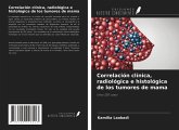 Correlación clínica, radiológica e histológica de los tumores de mama